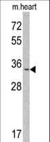 Polyclonal Rabbit anti-Human MLF1 Antibody (aa35-62, WB)