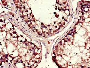 IHC-plus™ Polyclonal Rabbit anti-Human DYNC1H1 Antibody (IHC, IF)
