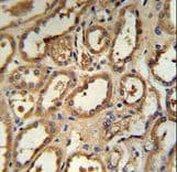 DCP2 Antibody (aa144-173)