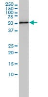 IHC-plus™ RBBP4 / RBAP48 Antibody (clone 2D7)