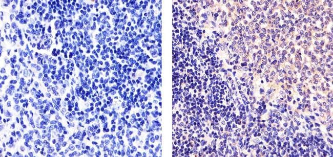 Monoclonal Mouse anti-Human RELB Antibody (clone 17.3, C-Terminus, IF, WB)
