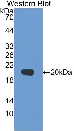 IL-1B / IL-1 Beta Antibody (aa95-262)