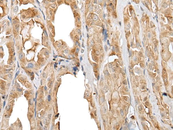 PRNP / PrP / Prion Antibody