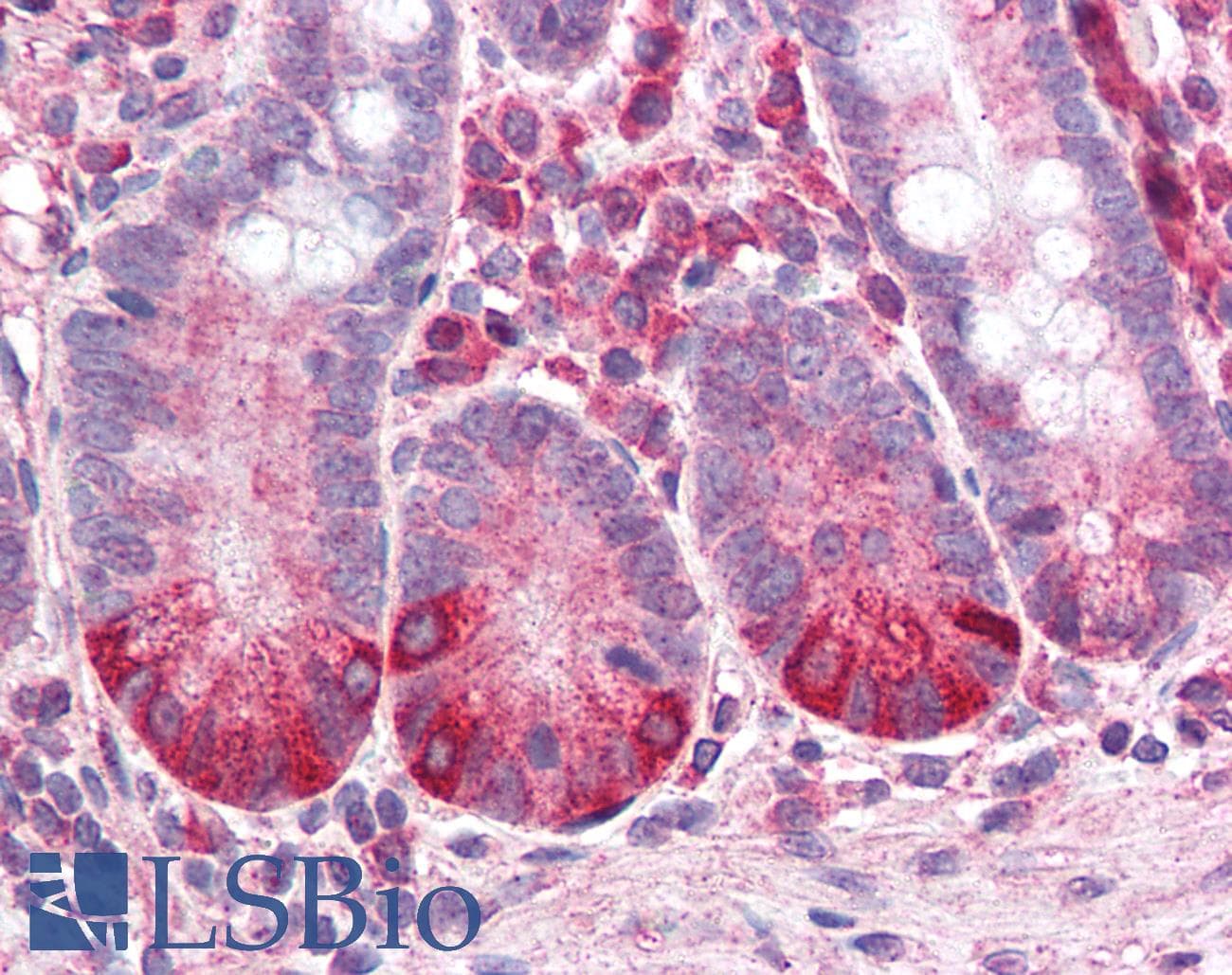IHC-plus™ CXCR2 Antibody