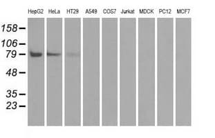 Monoclonal Mouse anti-Human BRAF / B-Raf Antibody (clone OTI1E2, IHC, IF, WB)