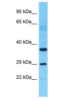 Polyclonal Rabbit anti-Human OR6C6 Antibody (aa246-295, WB)