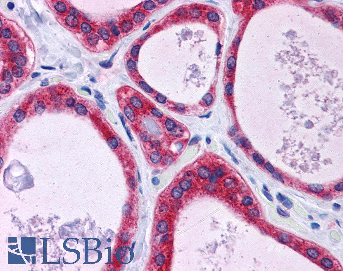 IHC-plus™ KCTD15 Antibody