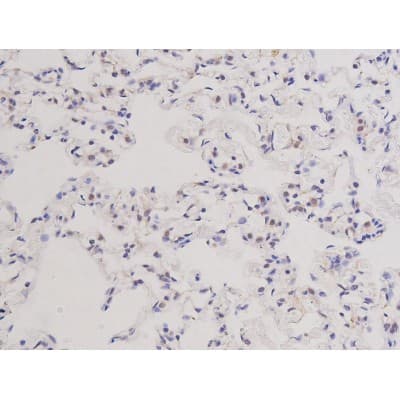 MKI67 / Ki67 Antibody