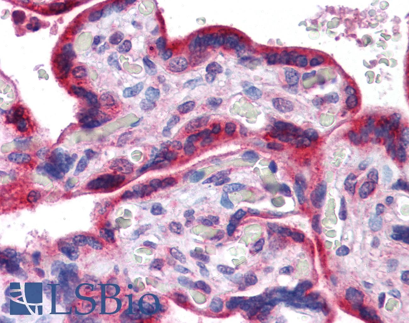 IHC-plus™ PLK1 / PLK-1 Antibody
