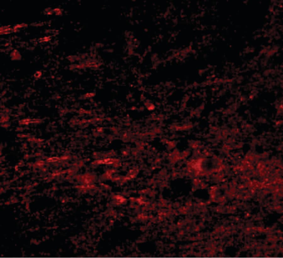 IHC-plus™ GALNT10 Antibody