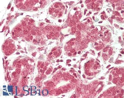 IHC-plus™ RAD21 Antibody (aa499-548)