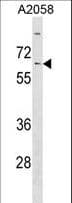 KLHL14 Antibody (aa392-418)
