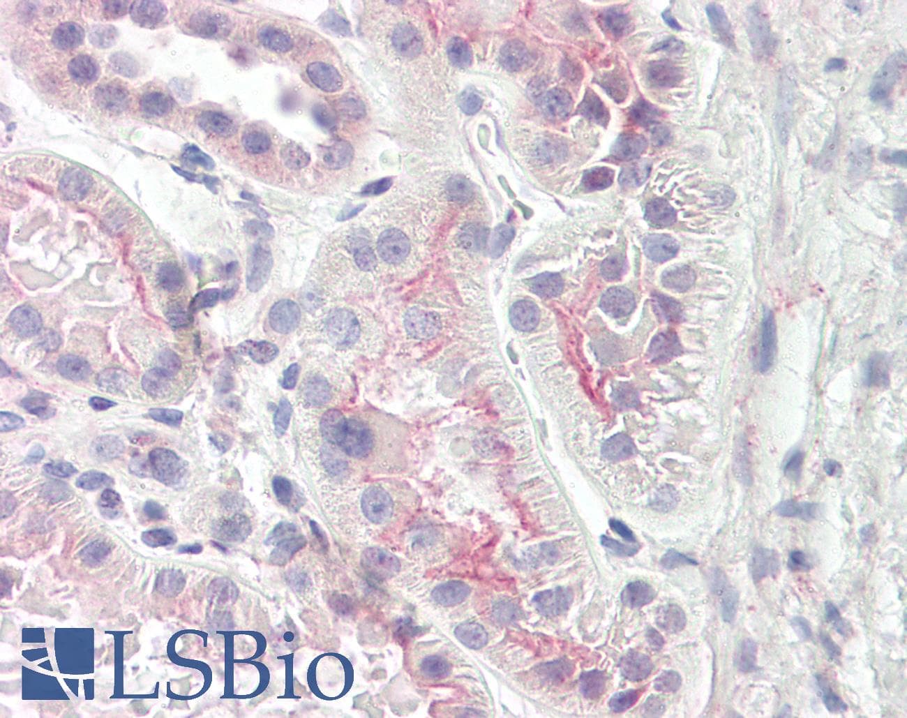 IHC-plus™ NPHP4 Antibody (aa877-926)