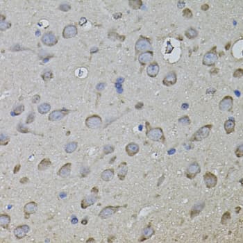Polyclonal Rabbit anti-Human CKAP4 Antibody (AP, IHC, WB)