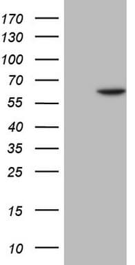 Monoclonal Mouse anti-Human FLT1 / VEGFR1 Antibody (clone OTI8G6, aa781-1338, WB)