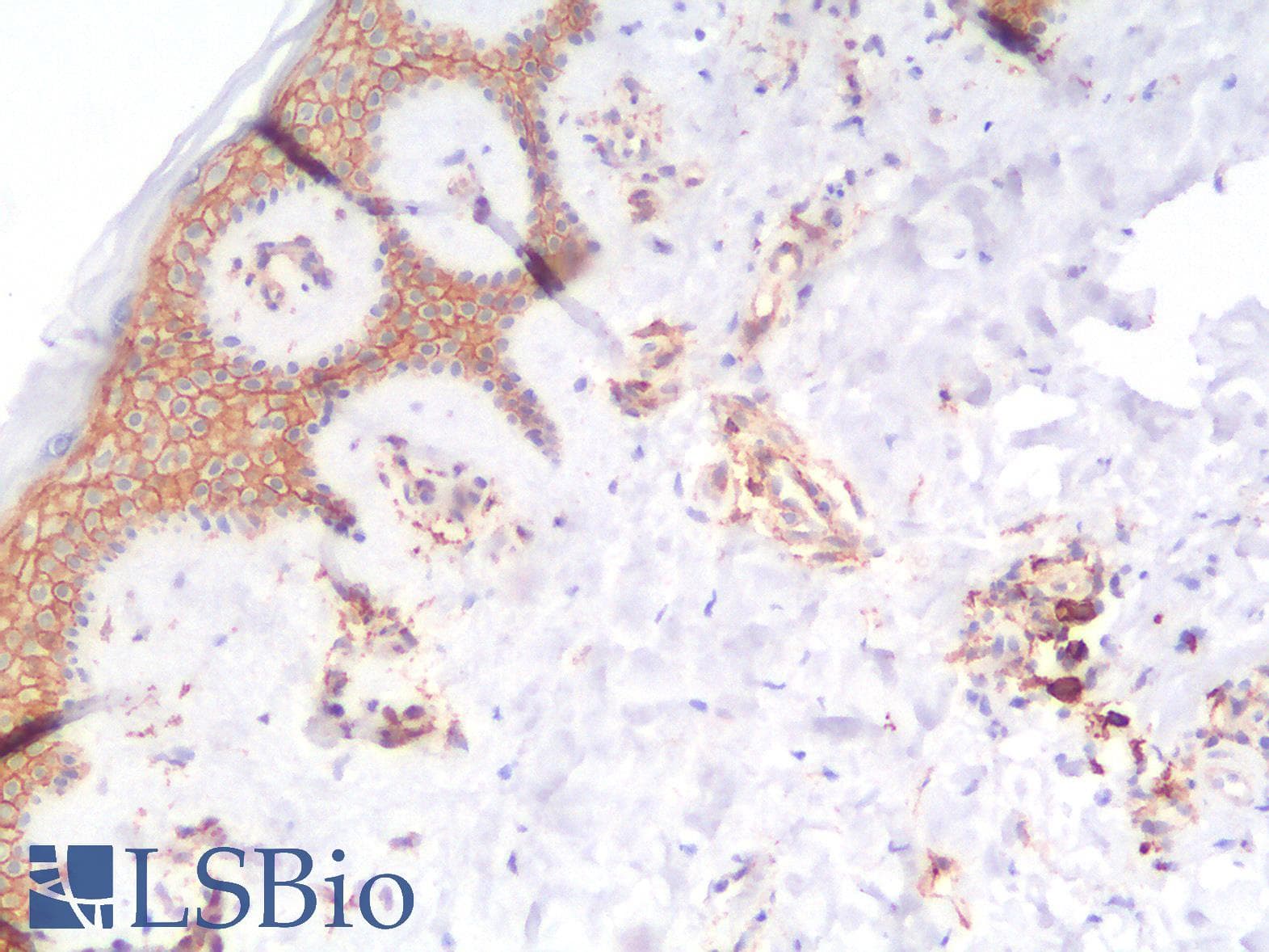 PathPlus™ THBD / CD141 / Thrombomodulin Antibody (aa 69-194, clone rTHBD/1591)