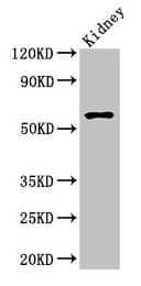 AMH / Anti-Mullerian Hormone Antibody