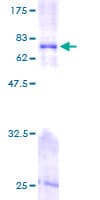 Human FKBP38 / FKBP8 Protein (Recombinant GST)