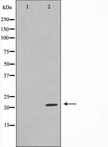 TPD52L2 / HD54 Antibody