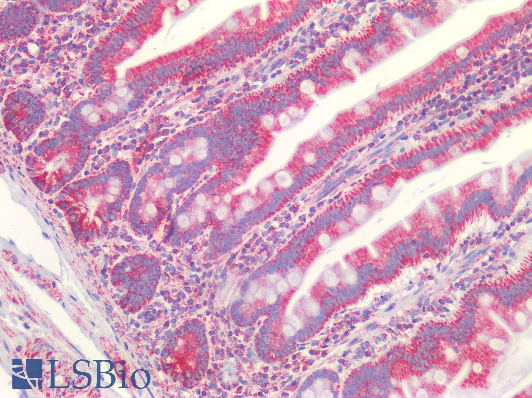 IHC-plus™ VDAC2 Antibody