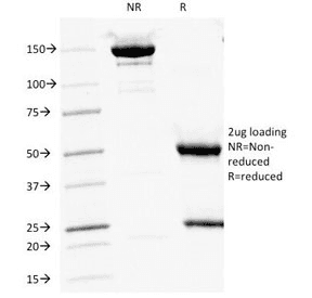 CD16 Antibody (clone HuNK2)