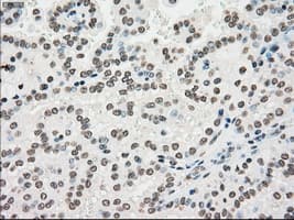 Monoclonal Mouse anti-Human PMEL / SILV / gp100 Antibody (clone OTI10E5, IHC, IF, WB)