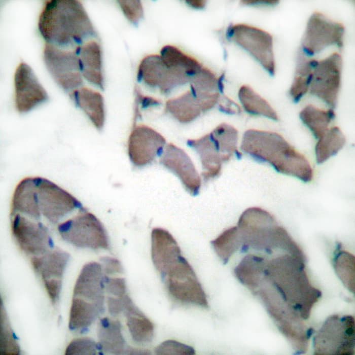 DES / Desmin Antibody (aa421-470)