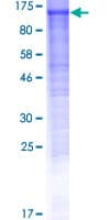 Human DDHD1 Protein (Recombinant GST)