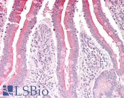 IHC-plus™ Polyclonal Goat anti-Human RGS18 Antibody (aa221-235, IHC, WB)