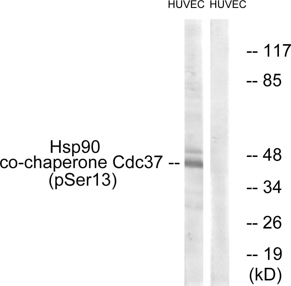 CDC37 Antibody (phospho-Ser13)