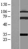 COIL / Coilin Protein (Over-Expression Lysate Myc-DDK (Flag))