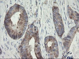 METAP2 Antibody (clone OTI1F6)