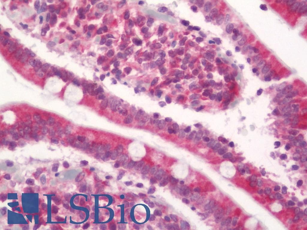 IHC-plus™ PLIN3 / M6PRBP1 / TIP47 Antibody (aa296-322)