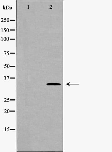 Polyclonal Rabbit anti-Human PPP4C Antibody (IHC, WB)