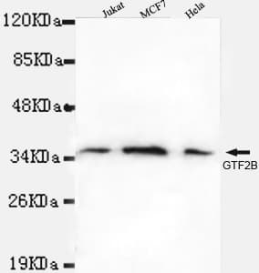 TFIIB Antibody