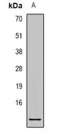 IHC-plus™ S100A1 / S100-A1 Antibody (Internal)