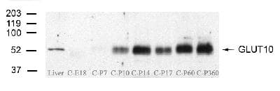SLC2A10 / GLUT10 Antibody (aa367-385)