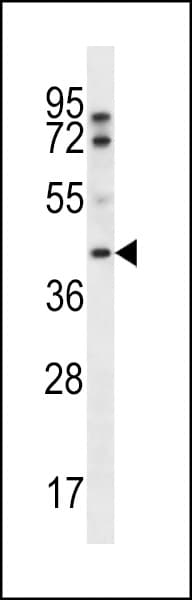 FIBP Antibody (aa98-127)