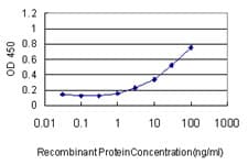 ACO1 / Aconitase Antibody (clone 2C1)