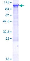 Human ZW10 Protein (Recombinant GST)