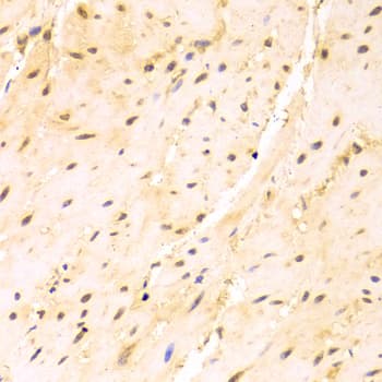 SRSF1 / SF2 Antibody
