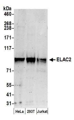 ELAC2 Antibody (aa150-200)