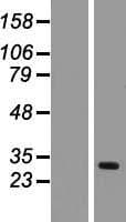 Human TIMM17A / TIM17 Protein (Over-Expression Lysate Myc-DDK (Flag))