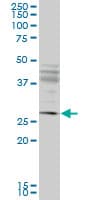 Monoclonal Mouse anti-Human IFT57 / HIPPI Antibody (clone 1G8, WB)