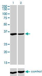 Monoclonal Mouse anti-Human FMR1 / FMRP Antibody (clone 2D4, WB)