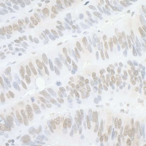 PPP4C Antibody (aa1-50)