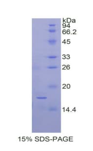 Human CEA / Carcinoembryonic Antigen Protein (Recombinant His)