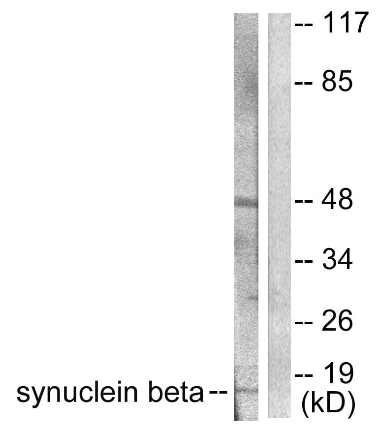 SNCB / Beta-Synuclein Antibody