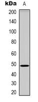 Polyclonal Rabbit anti-Human KIR3DL1 Antibody (N-Terminus, IHC, WB)