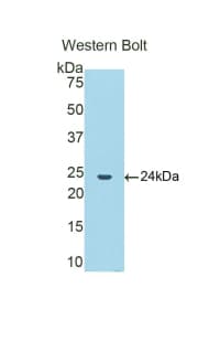 CTSB / Cathepsin B Antibody (aa129-333, APC)